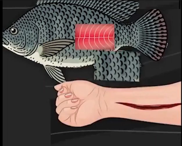 How Fish Skin Can be Used To Treat Skin Burn