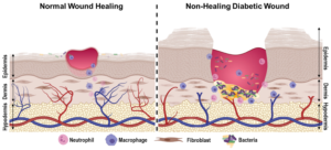 Bye-bye bandages? New technology heals wounds using patients’ blood.